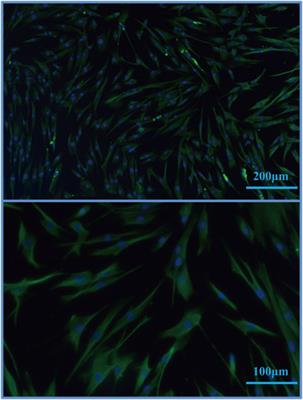 Treatment of Acute Wounds With Recombinant Human-Like Collagen and Recombinant Human-Like Fibronectin in C57BL/6 Mice Individually or in Combination